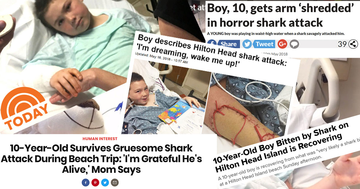 Jei’s Shark Attack Media Coverage